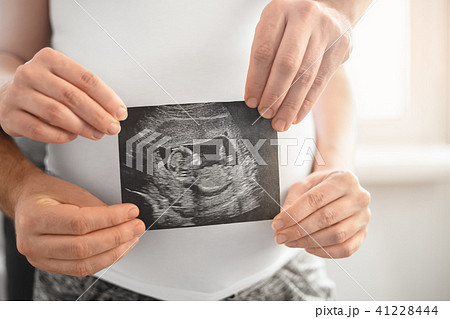 pregnant couple holding ultrasound scan pregnant couple holding ultrasound scan 41228444