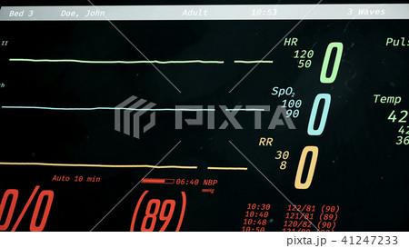 Patient dying, ICU monitor with dropping vital 41247233