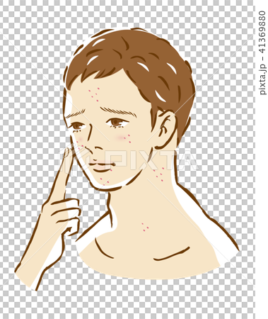 男性痘痘皮膚麻煩美容美容 41369880