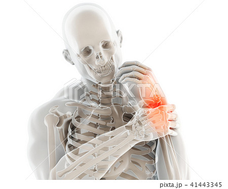 Wrist painful - skeleton x-ray. 41443345