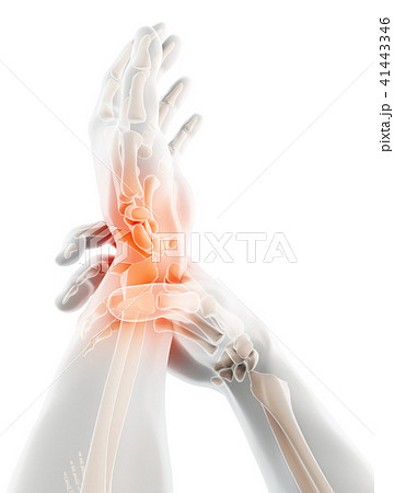 Wrist painful - skeleton x-ray. 41443346