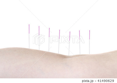 鍼治療 イメージ 41490629