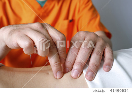 鍼治療 イメージ 41490634