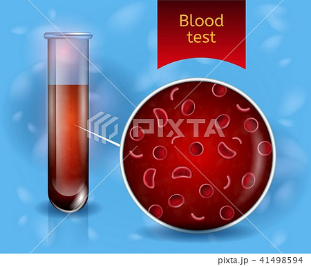 Medical Blood Test Realistic Vector Concept 41498594