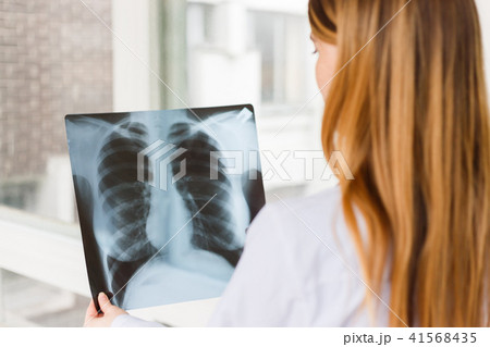 The doctor examines the x-ray image of the chest. 41568435