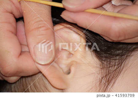 耳掃除　耳かき 41593709