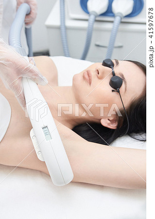Medical procedure. Removing underarm hair. removal 41597678