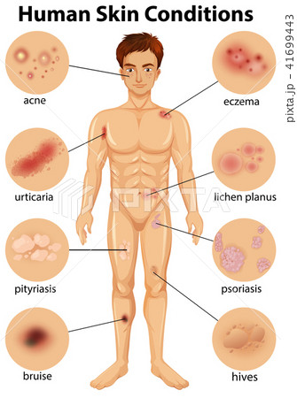 Various human skin conditions 41699443