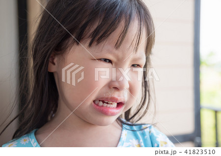 Little asian girl crying with running nose 41823510