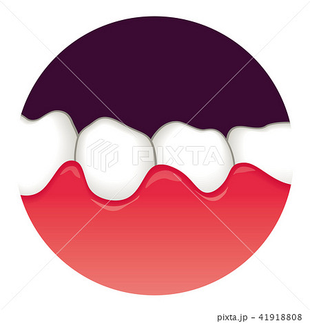 歯ぐきの腫れ　歯周病 41918808