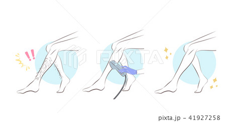 woman leg hair removal concept 41927258