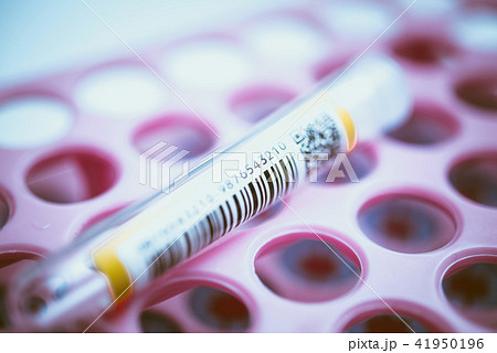 血液検査 41950196