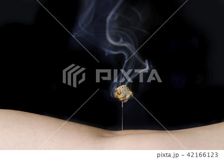 鍼治療 イメージ 42166123