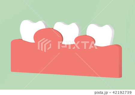 gingivitis or periodontal disease gingivitis or periodontal disease 42192739