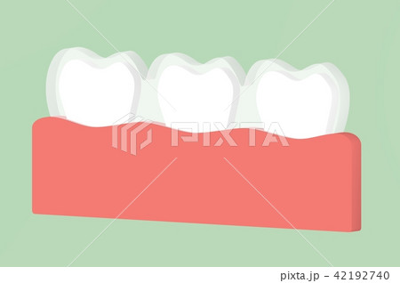 teeth wear silicone trainer or invisible braces teeth wear silicone trainer or invisible braces 42192740