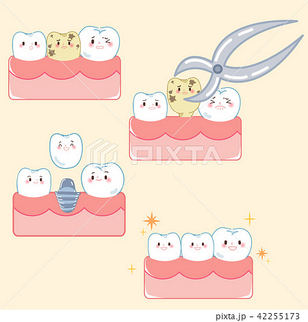 tooth with implant concept 42255173