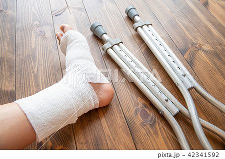 骨折した足と松葉杖 42341592