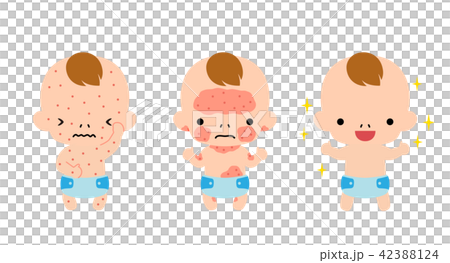 肌が弱い赤ちゃん 42388124