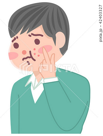 ニキビを気にする男の子 ニキビを気にする男の子 42403327