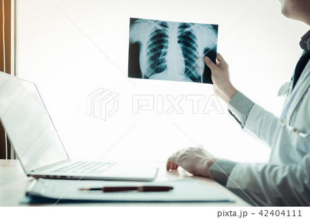 Doctor holding x-ray film at lap hospital office. Doctor holding x-ray film at lap hospital office. 42404111