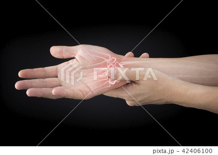 wrist bones injury 42406100