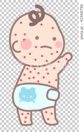 A baby with a rash - Stock Illustration [42568798] - PIXTA