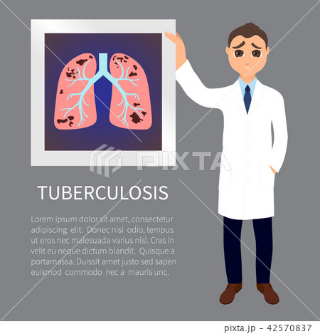 Tuberculosis awareness poster 42570837
