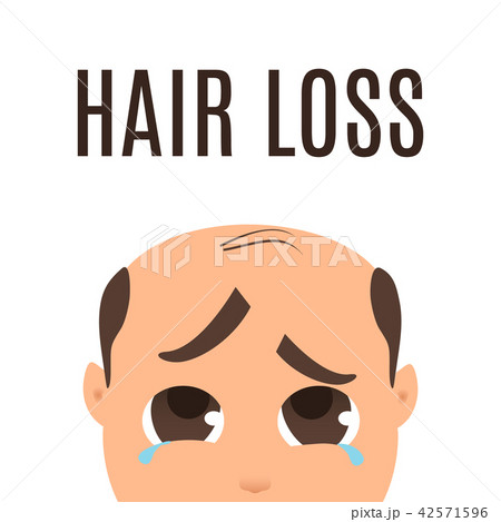Man with hair loss problem. Man with hair loss problem. 42571596