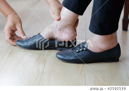 Elderly woman swollen feet putting on shoes 42592539