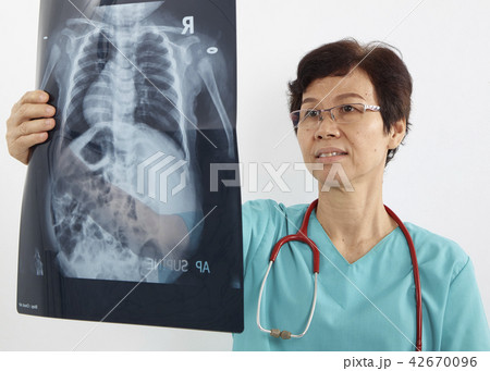 Doctors examining x-ray of chest 42670096