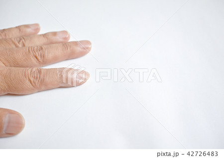 左手人差し指に貼った指先用保護フィルム 左手人差し指に貼った指先用保護フィルム 42726483