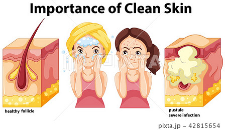 Importance of clean skin concept Importance of clean skin concept 42815654