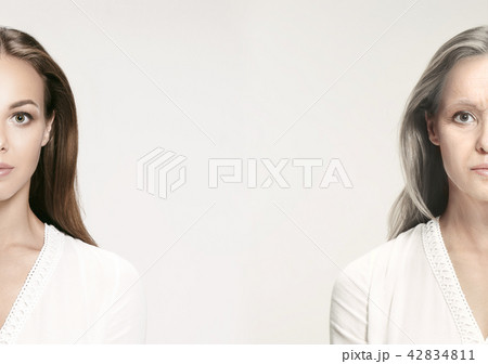 Comparison. Portrait of beautiful woman with problem and clean skin, aging and youth concept, beauty Comparison. Portrait of beautiful woman with problem and clean skin, aging and youth concept, beauty 42834811