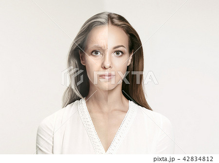 Comparison. Portrait of beautiful woman with problem and clean skin, aging and youth concept, beauty 42834812