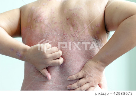 Patients are scratching their own back 42938675