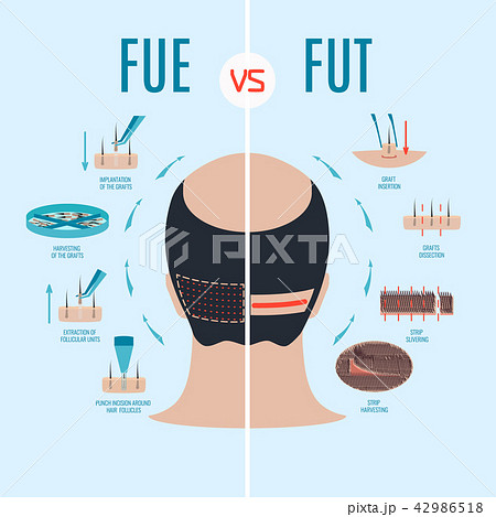 Fue Vs Futのイラスト素材