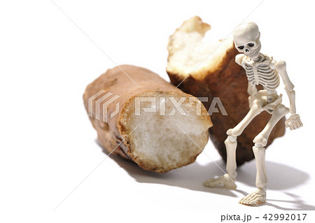 骨が折れるイメージ　骨粗鬆症 42992017