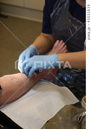 Wound on the leg Wound on the leg 43031614