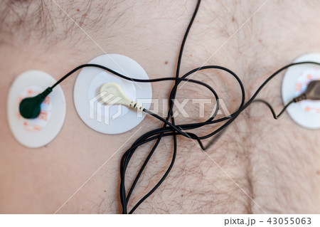 Holter monitor device on human male body. Daily cardiogram examination. Excess fat person. High risk 43055063