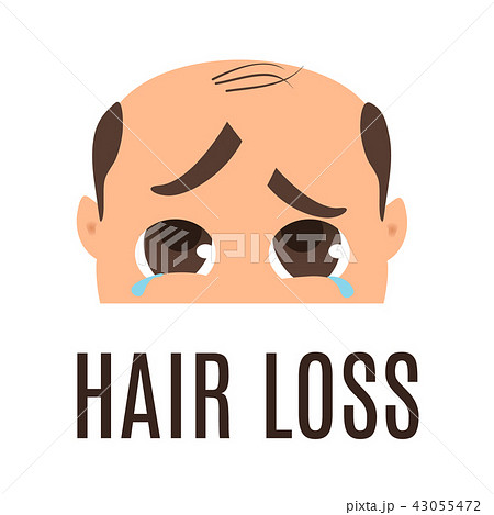 Man with hair loss problem. Man with hair loss problem. 43055472