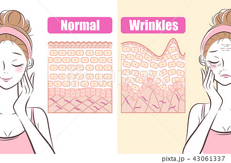 woman with wrinkles problem 43061337