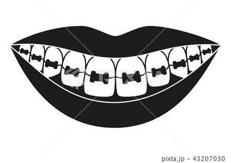 Black And White Healthy Smile In Braces Silhouetteのイラスト素材