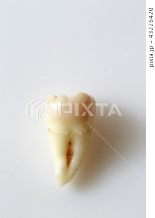 虫歯 43226420