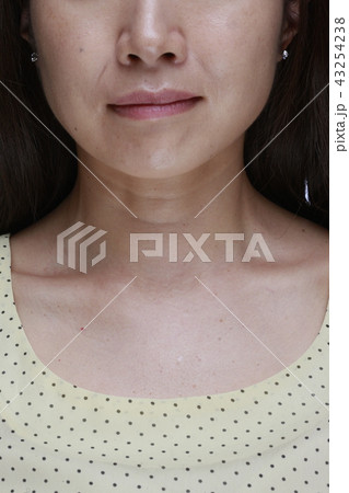 悩みのある口元・首元写真 悩みのある口元・首元写真 43254238