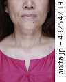 悩みのある口元・首元写真 43254239