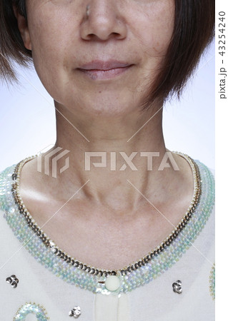 悩みのある口元・首元写真 悩みのある口元・首元写真 43254240