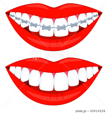 Colorful cartoon teeth aligning elements set 43414526