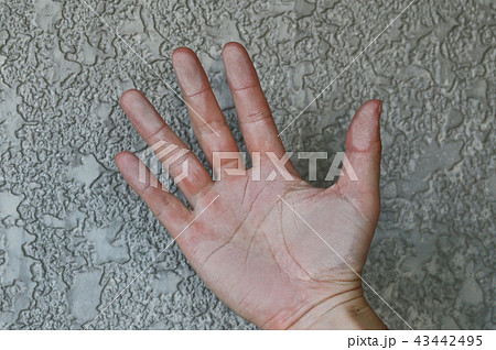 外壁のチョーキング 外壁のチョーキング 43442495