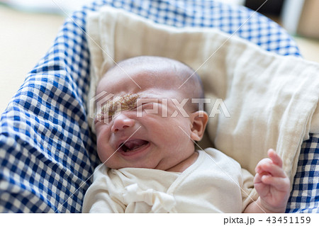 泣く新生児　乳児湿疹 43451159