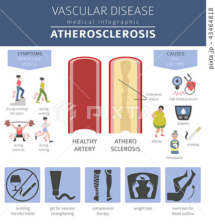 Vascular diseases. Atherosclerosis infographic 43464818